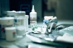 dental_cast2-scaled